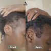 IN HAIRCARE Gélules Cure Pousse de Cheveux 1 mois