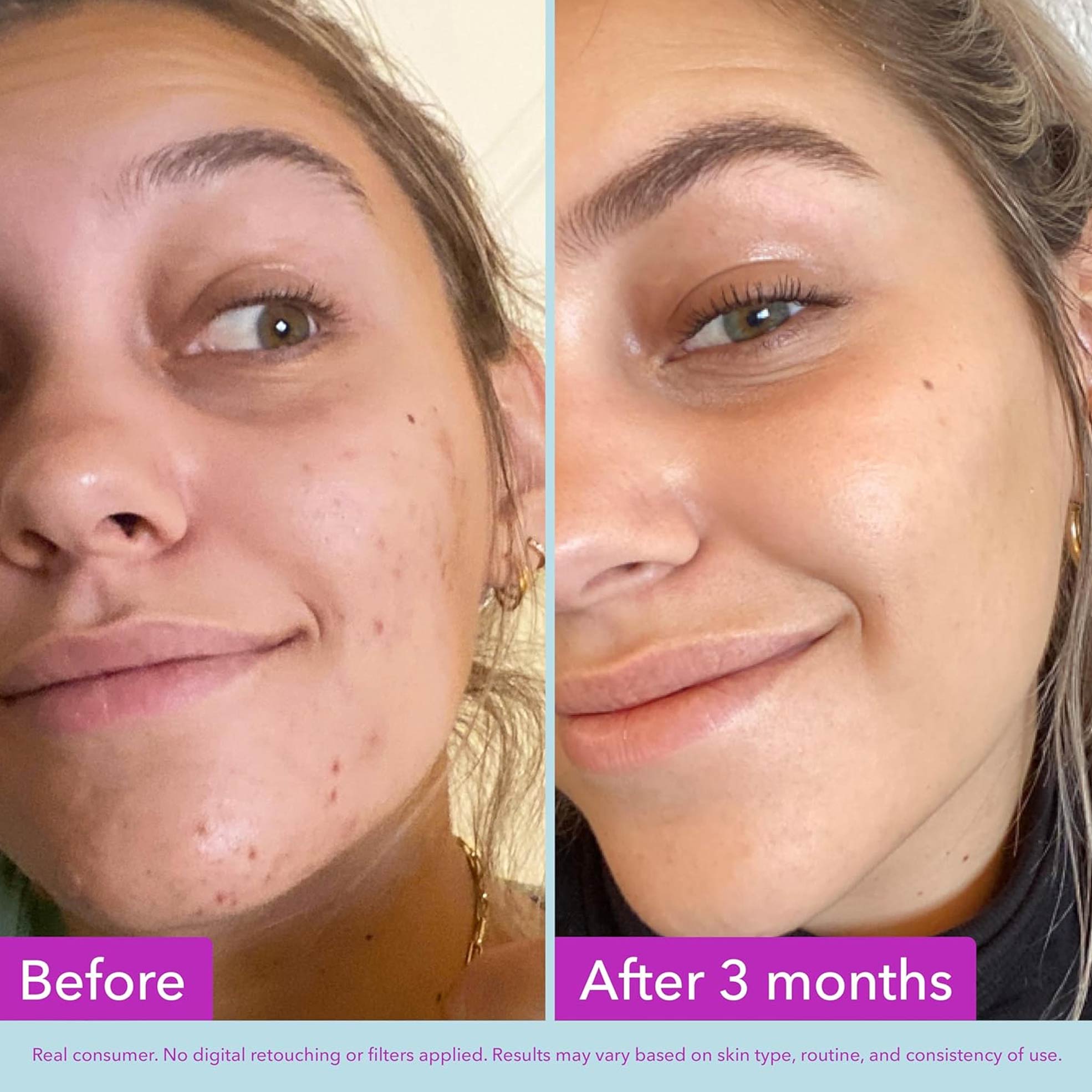 toner-good-molecules-before-after