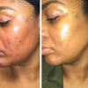 URBAN SKIN RX Even Tone Super Glow Serum