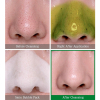 SOME BY MI Bye Bye Blackhead 30Days Miracle Green Tea Tox Nettoyant Bulles