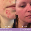Facetheory-gel-after-before