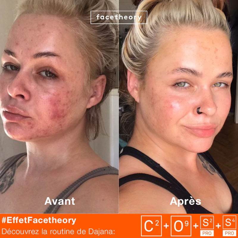 facetheory-regena-vitamin-c-serum