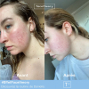 facetheory-solution-after-before