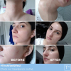 saliatica-before-after