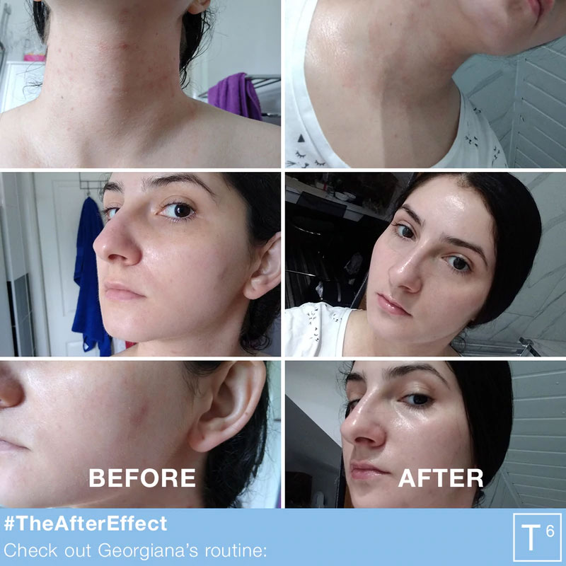 saliatica-before-after