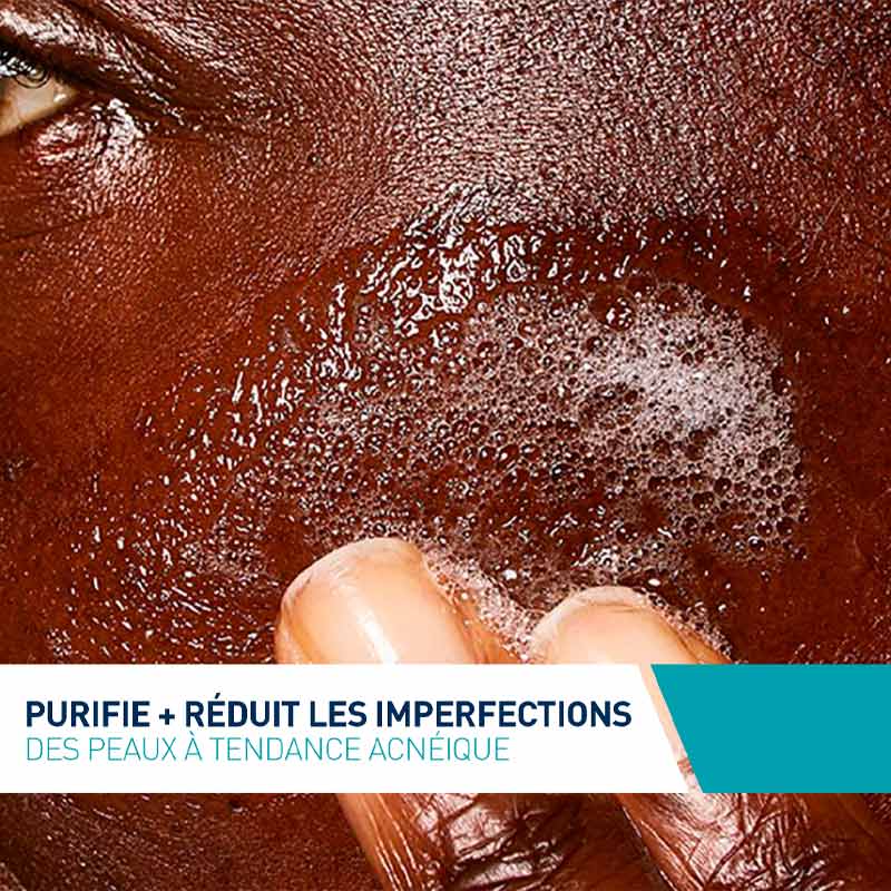 Cerave-nettoyant-anti-imperfections