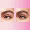 brow-lifting (1)