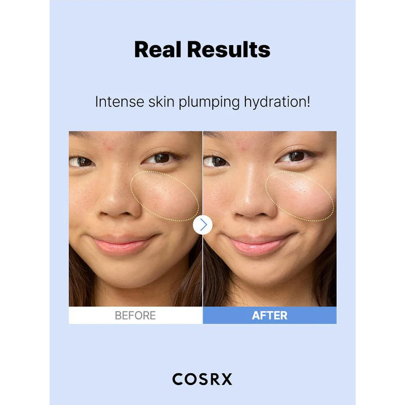 real-results-serum-hyalu