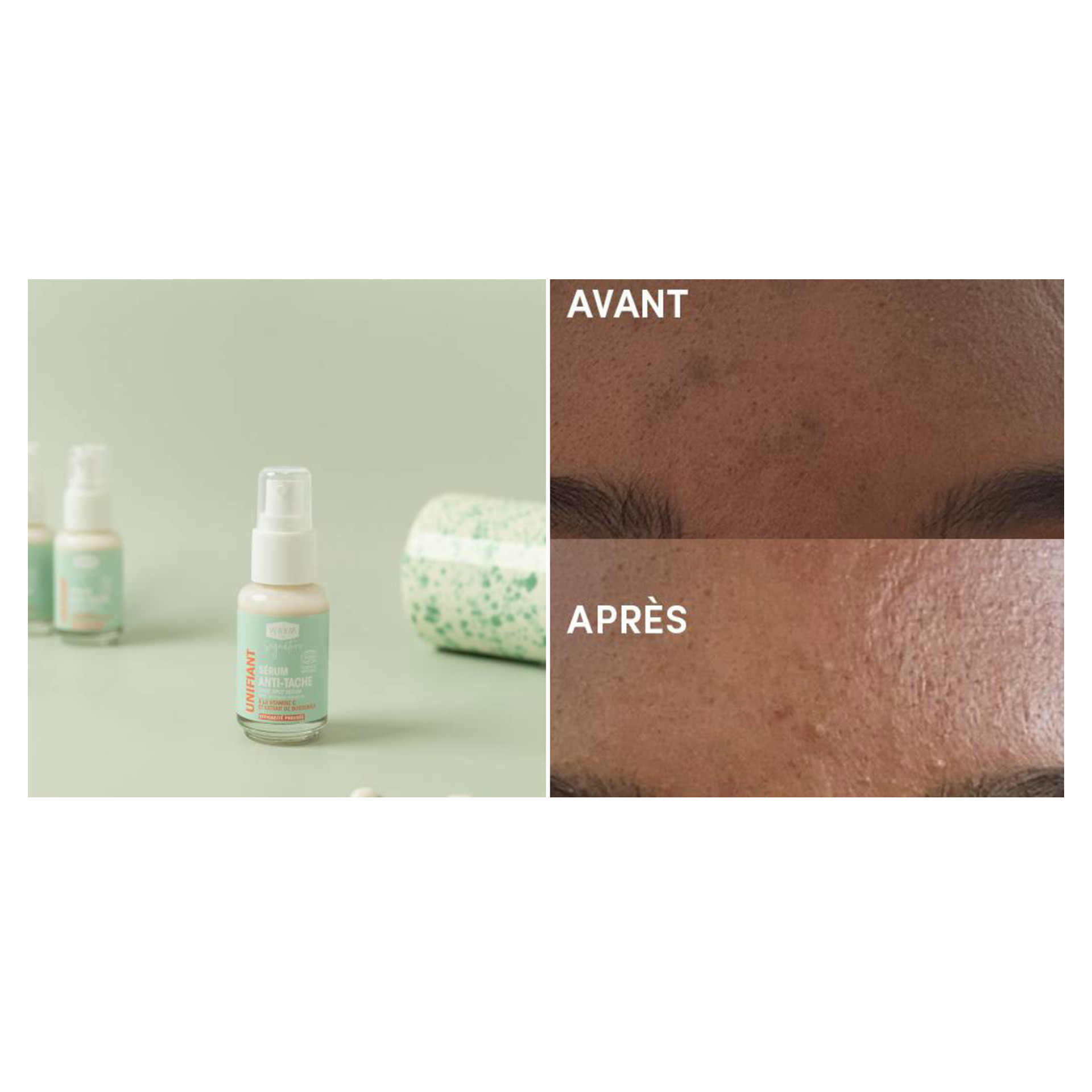 waam-before-et-after