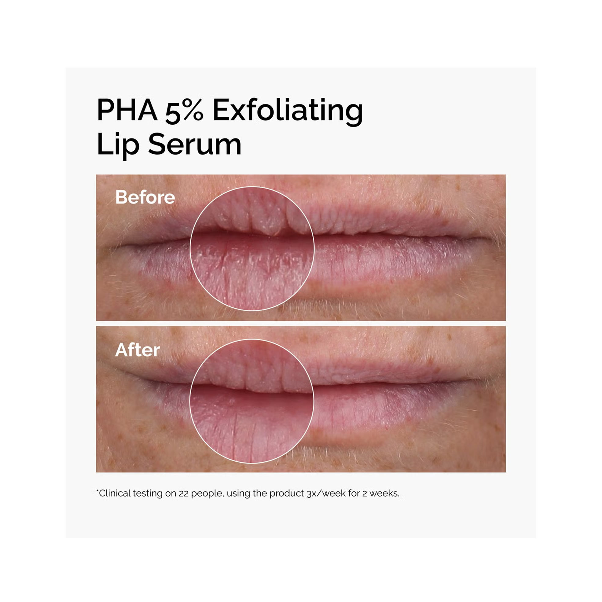 pha-exfoliatingg
