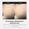 serum-one-day-medicube